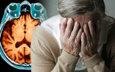 Alzheimer: nuovo studio per bloccare il processo degenerativo