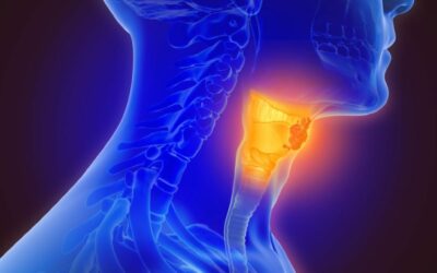 Carcinoma a cellule squamose delle vie aerodigestive superiori e il ruolo della metionina