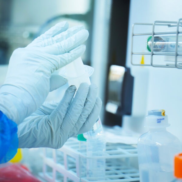 Cervello, un avatar per studiare il tumore pediatrico